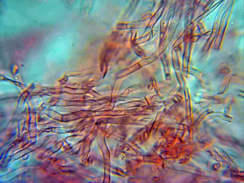 Ceriporia xylostromatoides 5 - Sistema monomítico sin fíbulas